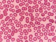 Red blood cells