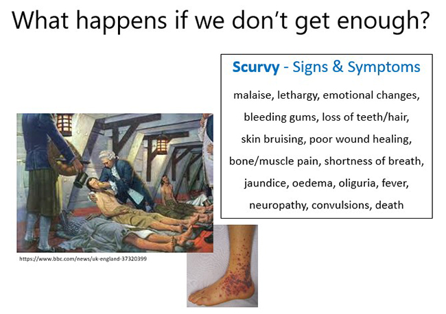 What happens if we don't get enough vitamin C